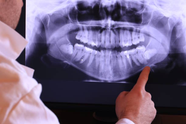 Best Emergency Treatment for Toothache in Rosanky, TX